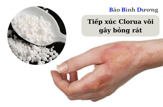 Clorua-voi-la-muoi-gi-Bat-mi-hop-chat-khu-trung-quen-thuoc